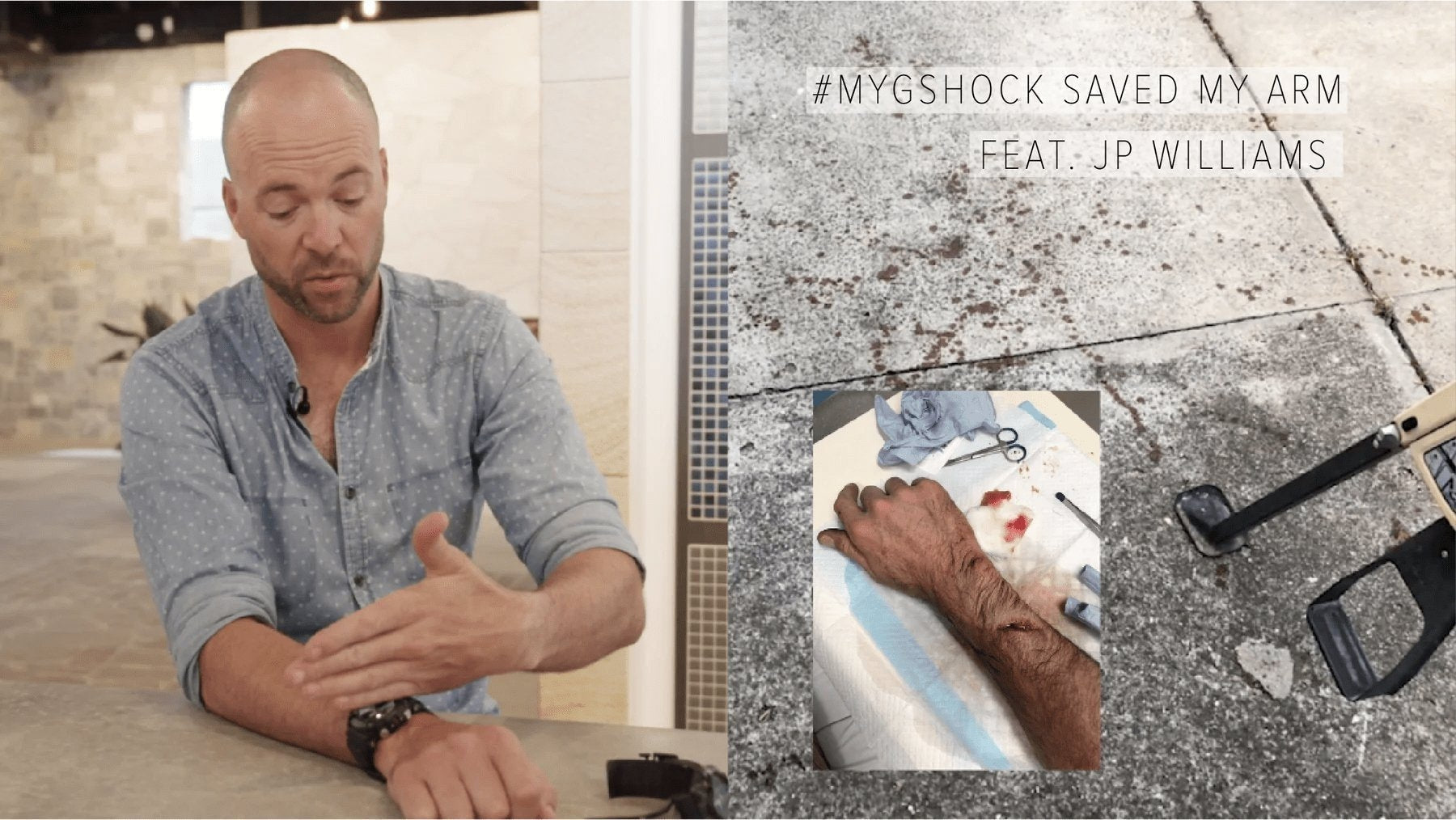 #MYGSHOCK SAVED MY ARM Feat. JP Williams